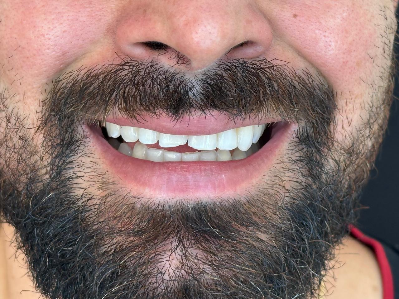 Resultado 9